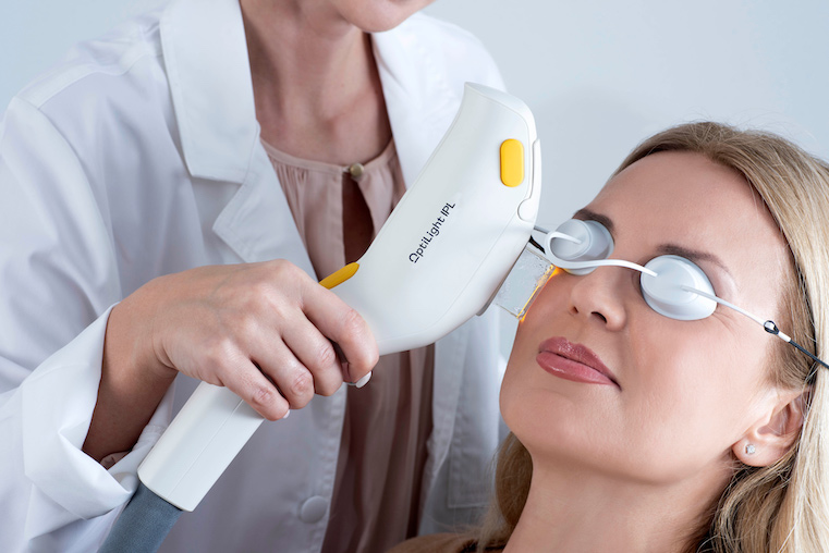 A doctor performing OptiLight treatment on a patient